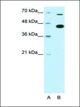 Anti-ZBTB33 antibody produced in rabbit affinity isolated antibody