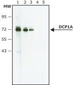 Anti-DCP1A (N-terminal) antibody produced in rabbit ~1.0&#160;mg/mL, affinity isolated antibody, buffered aqueous solution