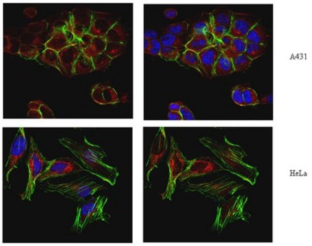 Anti-TGN46, Antibody from rabbit, purified by affinity chromatography