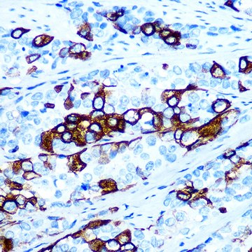 Anti-Cytokeratin 5 (KRT5) Antibody, clone 3P3T9, Rabbit Monoclonal