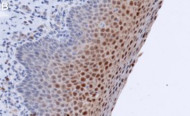 Anti-MRP-8/14 Antibody, clone AHN-17 ZooMAb&#174; Mouse Monoclonal recombinant, expressed in HEK 293 cells