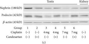 Anti-Podocin antibody produced in rabbit affinity isolated antibody, buffered aqueous solution