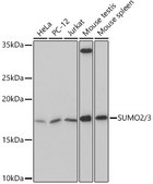 Anti-SUMO2/3 Antibody, clone 6R8G7, Rabbit Monoclonal