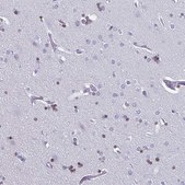 Anti-OLIG2 antibody produced in rabbit Prestige Antibodies&#174; Powered by Atlas Antibodies, affinity isolated antibody, buffered aqueous glycerol solution