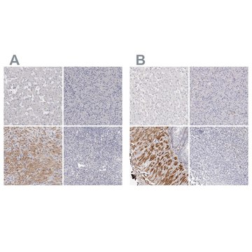 Anti-LMOD1 antibody produced in rabbit Prestige Antibodies&#174; Powered by Atlas Antibodies, affinity isolated antibody, buffered aqueous glycerol solution, ab2