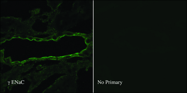 Anti-SCNN1G antibody produced in rabbit 1&#160;mg/mL, affinity isolated antibody