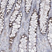 Anti-B3GNT7 antibody produced in rabbit Prestige Antibodies&#174; Powered by Atlas Antibodies, affinity isolated antibody, buffered aqueous glycerol solution