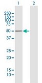 Anti-PRKAR1B antibody produced in mouse purified immunoglobulin, buffered aqueous solution