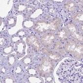 Anti-DHRS2 antibody produced in rabbit Prestige Antibodies&#174; Powered by Atlas Antibodies, affinity isolated antibody, buffered aqueous glycerol solution