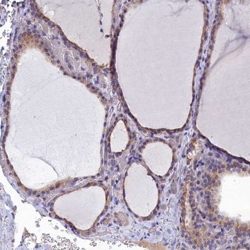 Anti-RABGAP1 antibody produced in rabbit Prestige Antibodies&#174; Powered by Atlas Antibodies, affinity isolated antibody, buffered aqueous glycerol solution