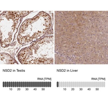 Anti-NSD2 antibody produced in rabbit Prestige Antibodies&#174; Powered by Atlas Antibodies, affinity isolated antibody, buffered aqueous glycerol solution