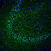 Anti-DPP6 antibody produced in rabbit Prestige Antibodies&#174; Powered by Atlas Antibodies, affinity isolated antibody, buffered aqueous glycerol solution