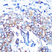 Anti-HDAC6 Antibody, clone 9V1W2, Rabbit Monoclonal