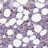 Anti-MMP9 antibody produced in rabbit Prestige Antibodies&#174; Powered by Atlas Antibodies, affinity isolated antibody, buffered aqueous glycerol solution