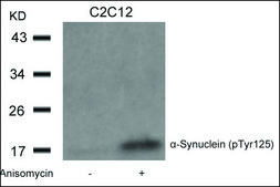 Anti-phospho-SNCA (pTyr125) antibody produced in rabbit affinity isolated antibody
