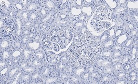 Anti-Spectrin &#945; Antibody, clone 2G17 ZooMAb&#174; Rabbit Monoclonal recombinant, expressed in HEK 293 cells
