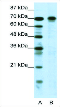 Anti-HIC1 antibody produced in rabbit affinity isolated antibody