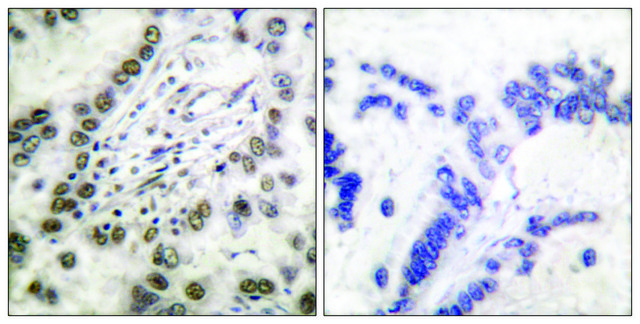 Anti-CBP antibody produced in rabbit affinity isolated antibody