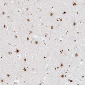 Anti-SMARCA2 antibody produced in rabbit Prestige Antibodies&#174; Powered by Atlas Antibodies, affinity isolated antibody, buffered aqueous glycerol solution