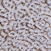 Anti-CD36 antibody produced in rabbit Prestige Antibodies&#174; Powered by Atlas Antibodies, affinity isolated antibody, buffered aqueous glycerol solution