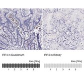 Anti-IRF4 antibody produced in rabbit Prestige Antibodies&#174; Powered by Atlas Antibodies, affinity isolated antibody, buffered aqueous glycerol solution