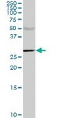 Monoclonal Anti-CA1 antibody produced in mouse clone M2, purified immunoglobulin, buffered aqueous solution