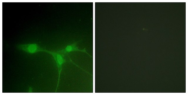 Anti-Breast Tumor Kinase antibody produced in rabbit affinity isolated antibody