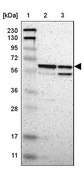 Anti-ARHGAP1 antibody produced in rabbit Ab2, Prestige Antibodies&#174; Powered by Atlas Antibodies, affinity isolated antibody, buffered aqueous glycerol solution