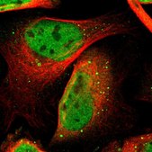 Anti-CDK9 antibody produced in rabbit Prestige Antibodies&#174; Powered by Atlas Antibodies, affinity isolated antibody, buffered aqueous glycerol solution