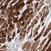 Anti-PPP1R12B antibody produced in rabbit Prestige Antibodies&#174; Powered by Atlas Antibodies, affinity isolated antibody, buffered aqueous glycerol solution, Ab1