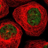 Anti-TARDBP antibody produced in rabbit affinity isolated antibody, buffered aqueous glycerol solution