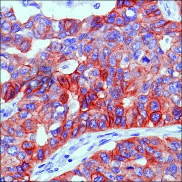 Anti-EGFR antibody, Rabbit monoclonal clone SP84, recombinant, expressed in proprietary host, affinity isolated antibody