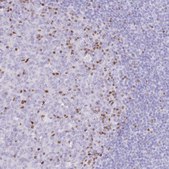 Anti-TOX2 antibody produced in rabbit Prestige Antibodies&#174; Powered by Atlas Antibodies, affinity isolated antibody, buffered aqueous glycerol solution