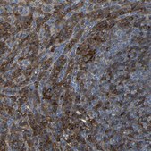 Anti-ADGRE5 antibody produced in rabbit Prestige Antibodies&#174; Powered by Atlas Antibodies, affinity isolated antibody, buffered aqueous glycerol solution