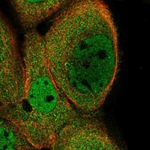 Anti-KIFC2 antibody produced in rabbit Prestige Antibodies&#174; Powered by Atlas Antibodies, affinity isolated antibody, buffered aqueous glycerol solution