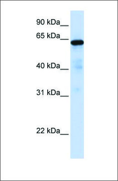 Anti-FOXN4 antibody produced in rabbit affinity isolated antibody