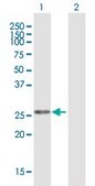Anti-MFAP2 antibody produced in mouse purified immunoglobulin, buffered aqueous solution