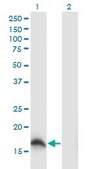 Monoclonal Anti-SOD1 antibody produced in mouse clone 10D5, purified immunoglobulin, buffered aqueous solution