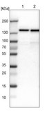 Anti-UBE4B antibody produced in rabbit Prestige Antibodies&#174; Powered by Atlas Antibodies, affinity isolated antibody, buffered aqueous glycerol solution