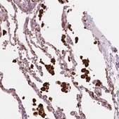 Anti-CES1 antibody produced in rabbit Prestige Antibodies&#174; Powered by Atlas Antibodies, affinity isolated antibody, buffered aqueous glycerol solution