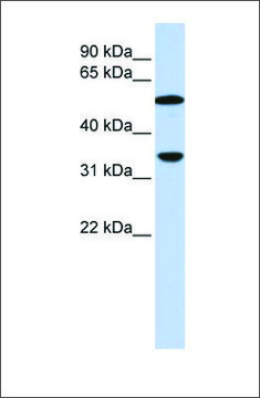 Anti-C4B antibody produced in rabbit affinity isolated antibody