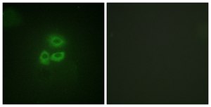 Anti-PKD1 antibody produced in rabbit affinity isolated antibody
