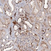 Anti-ALKBH8 antibody produced in rabbit Prestige Antibodies&#174; Powered by Atlas Antibodies, affinity isolated antibody, buffered aqueous glycerol solution