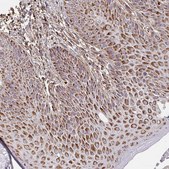 Anti-MAVS antibody produced in rabbit Prestige Antibodies&#174; Powered by Atlas Antibodies, affinity isolated antibody, buffered aqueous glycerol solution