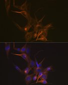 Anti-Tubulin beta-1 chain Antibody, clone 2Z6P1, Rabbit Monoclonal