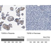 Anti-TGFBI antibody produced in rabbit Prestige Antibodies&#174; Powered by Atlas Antibodies, affinity isolated antibody, buffered aqueous glycerol solution
