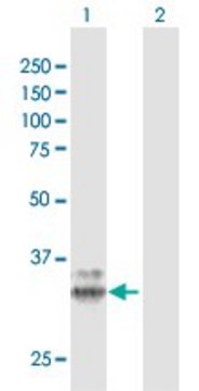 Anti-PPT1 antibody produced in rabbit purified immunoglobulin, buffered aqueous solution