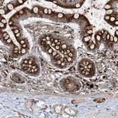 Anti-MX1 antibody produced in rabbit Prestige Antibodies&#174; Powered by Atlas Antibodies, affinity isolated antibody, buffered aqueous glycerol solution