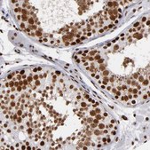Anti-MRE11 antibody produced in rabbit Prestige Antibodies&#174; Powered by Atlas Antibodies, affinity isolated antibody, buffered aqueous glycerol solution
