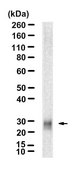 Anti-SLC31A1/CTR1 Antibody, clone 1K21 ZooMAb&#174; Rabbit Monoclonal recombinant, expressed in HEK 293 cells